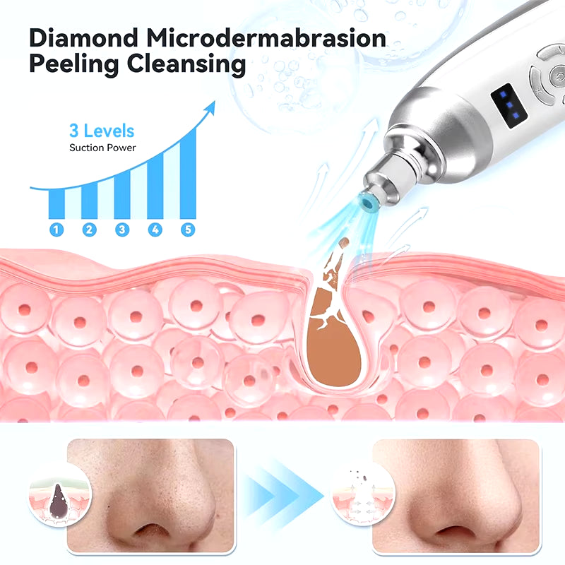 Upgraded Diamond Microdermabrasion Machine Blackhead Removal Professional Facial Deep Cleasing Device Home Use Facial Skin Care