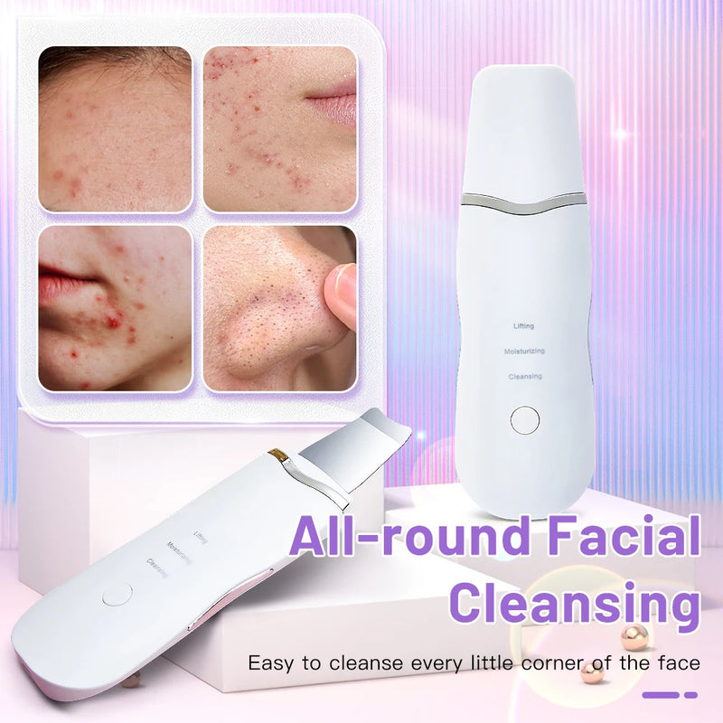 Electric Skin Scrubber Peeling Blackhead Remover Deep Face Cleaning Facial Lifting Acne Cleaner Facial Ultrasonic Shovel Clean