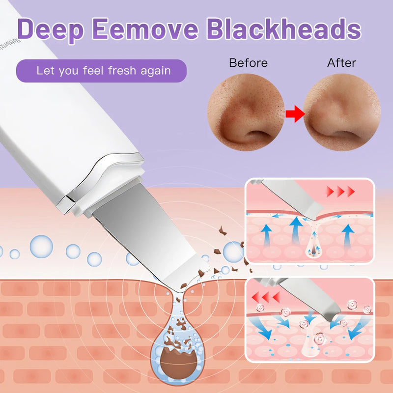 Electric Skin Scrubber Peeling Blackhead Remover Deep Face Cleaning Facial Lifting Acne Cleaner Facial Ultrasonic Shovel Clean