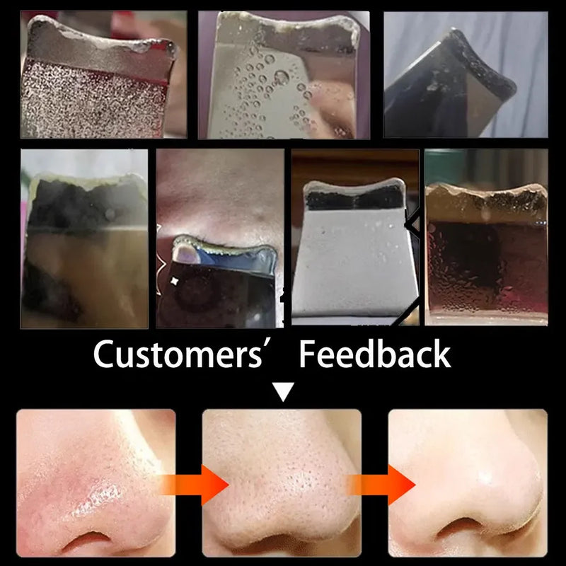 Electric Skin Scrubber Peeling Blackhead Remover Deep Face Cleaning Facial Lifting Acne Cleaner Facial Ultrasonic Shovel Clean