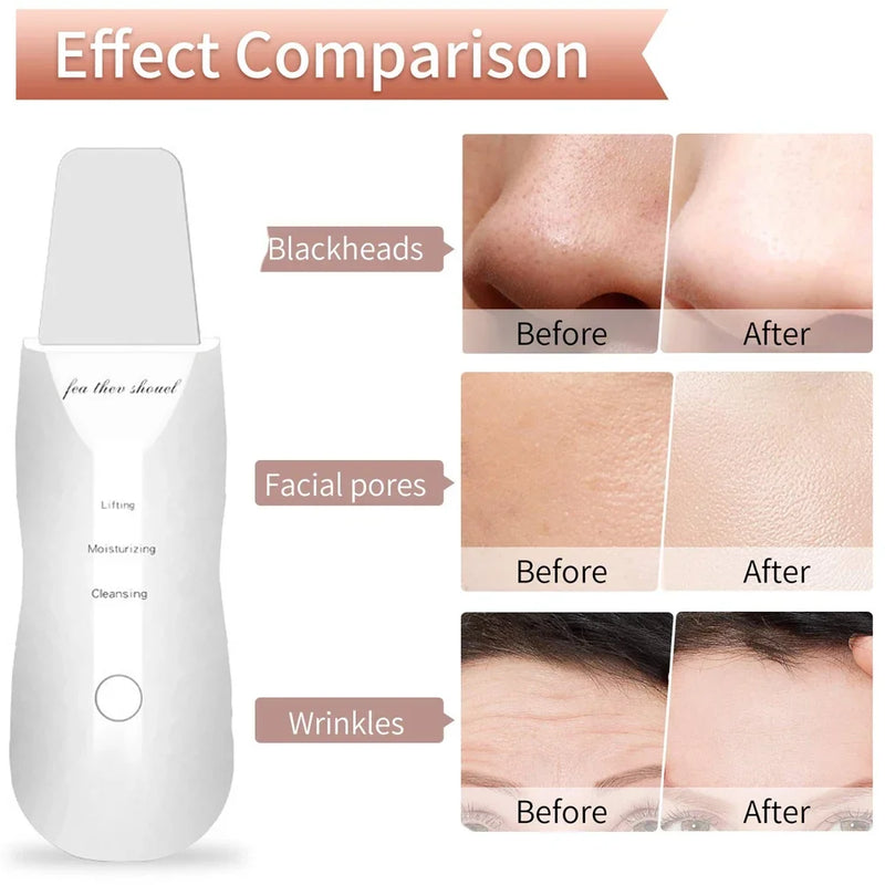 Electric Skin Scrubber Peeling Blackhead Remover Deep Face Cleaning Facial Lifting Acne Cleaner Facial Ultrasonic Shovel Clean